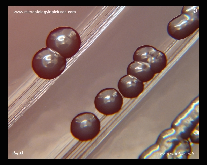 hemolysis